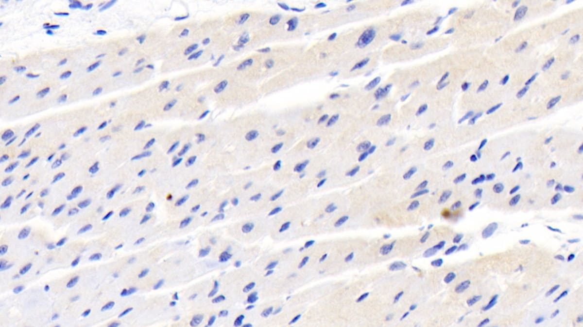 ACBP Antibody (C6)