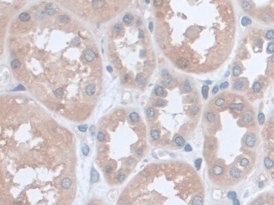 UCP2 Antibody (C1)