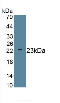 LAMC2 Antibody (D7)