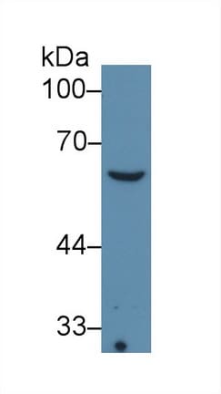 Collagen VIII alpha 1 Antibody (C3)