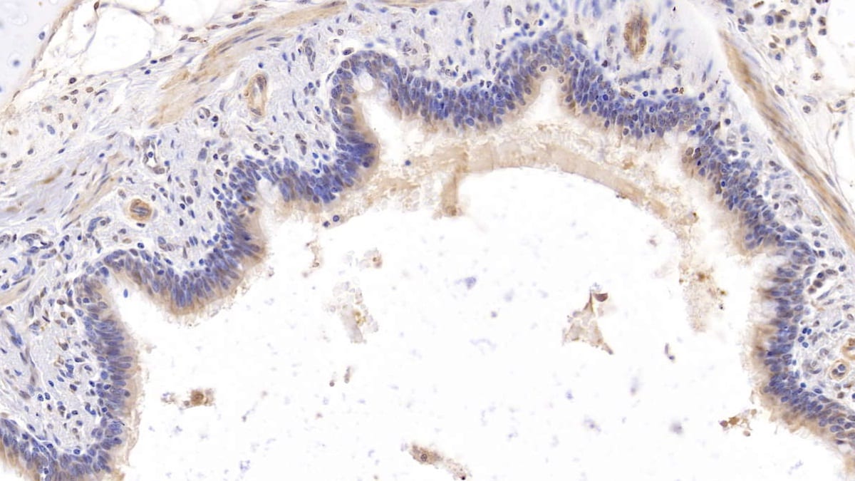 Collagen VIII alpha 1 Antibody (C3)