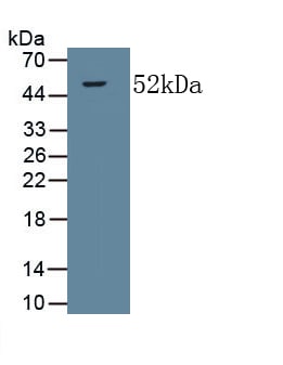 Collagen V alpha 2 Antibody (C4)