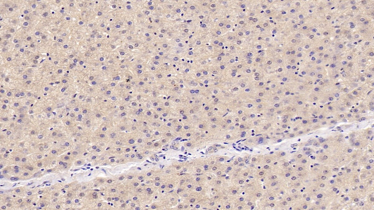 OAS1 Antibody (C5)