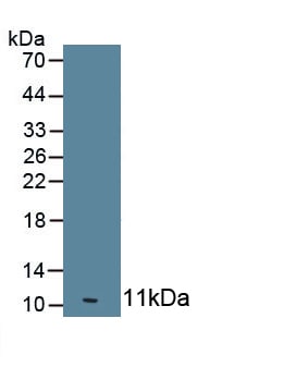 OAS1 Antibody (C5)