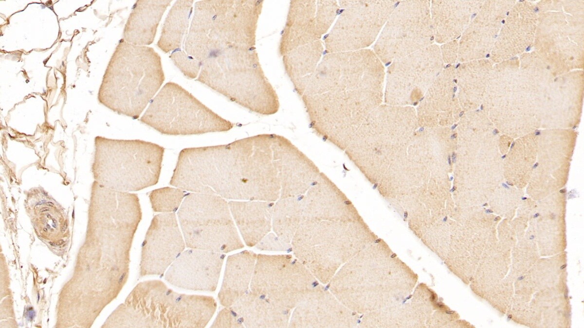 VHR/DUSP3 Antibody (2#)