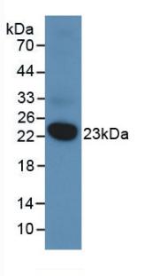 VHR/DUSP3 Antibody (2#)