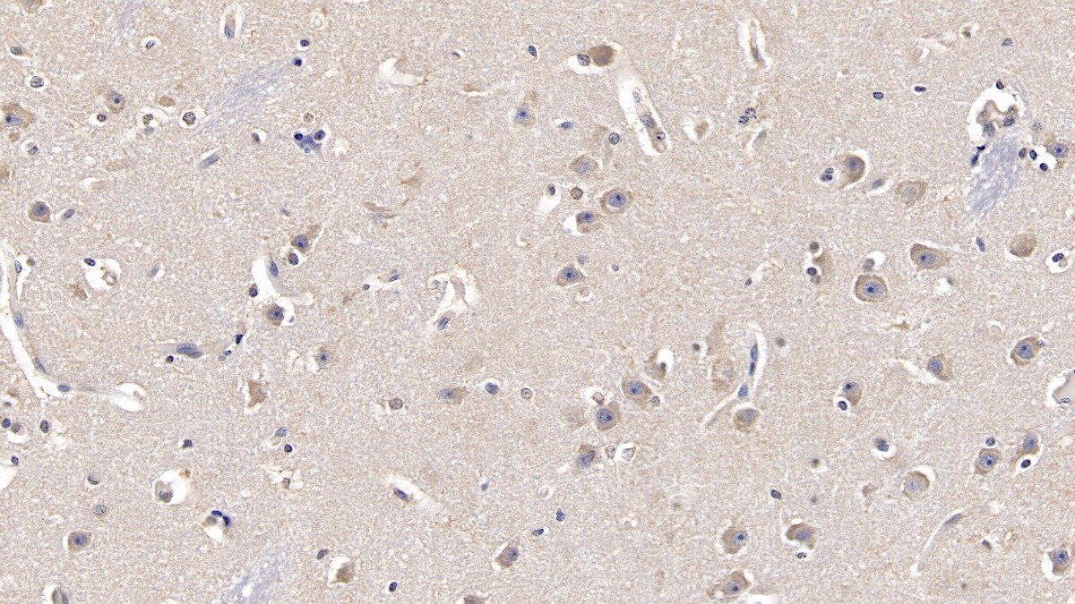 FGF-13 Antibody (C1)