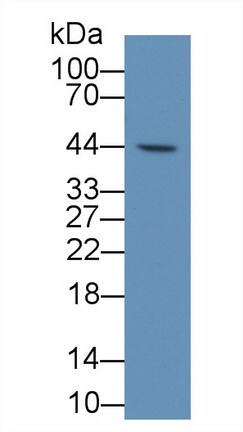 TDO2 Antibody (C1)