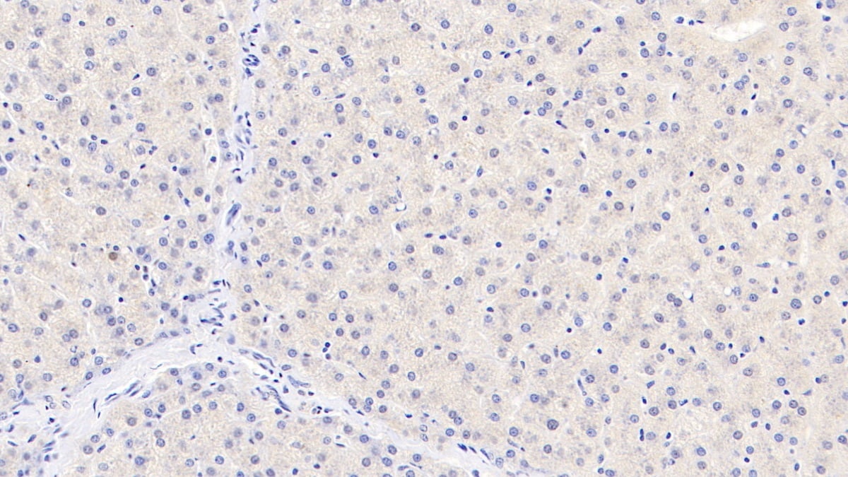 TDO2 Antibody (C1)