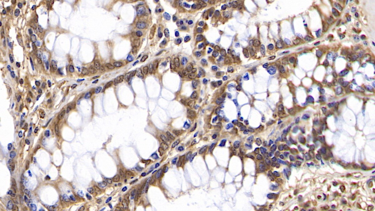 OAS2 Antibody (C1)