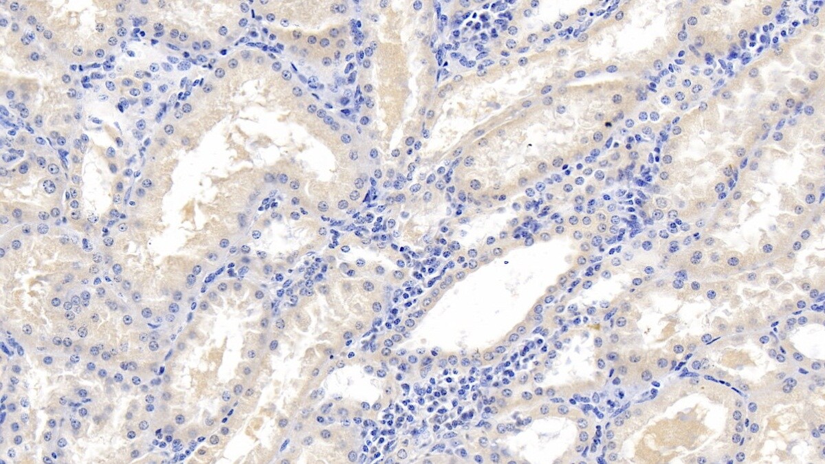 MAPRE1 Antibody (C1)