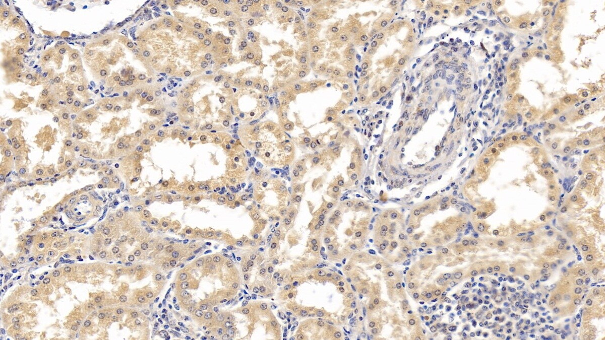 IFN-alpha F/IFNA21 Antibody (D4)