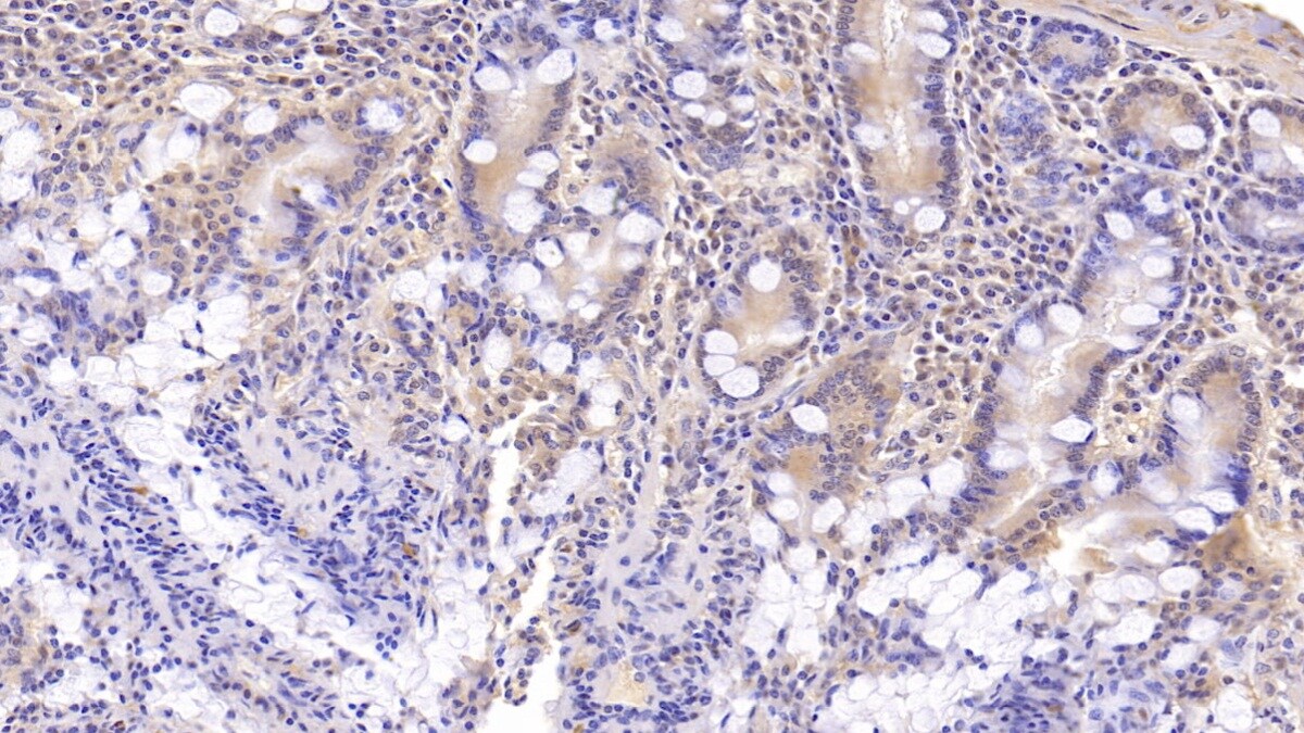 DNAH11 Antibody (C5)