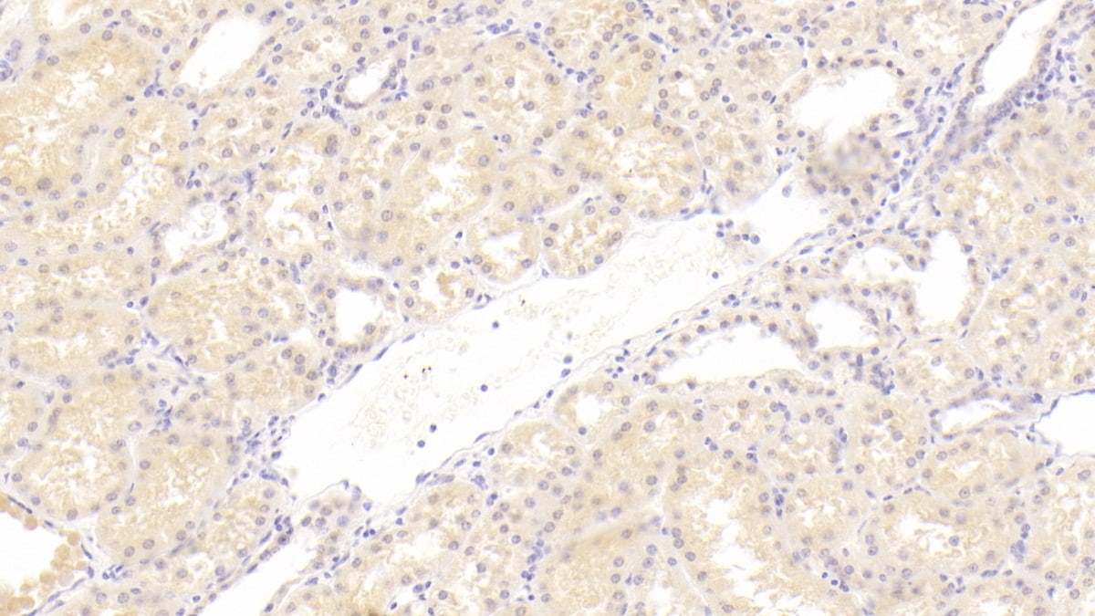 C1qTNF1/CTRP1 Antibody (C2)