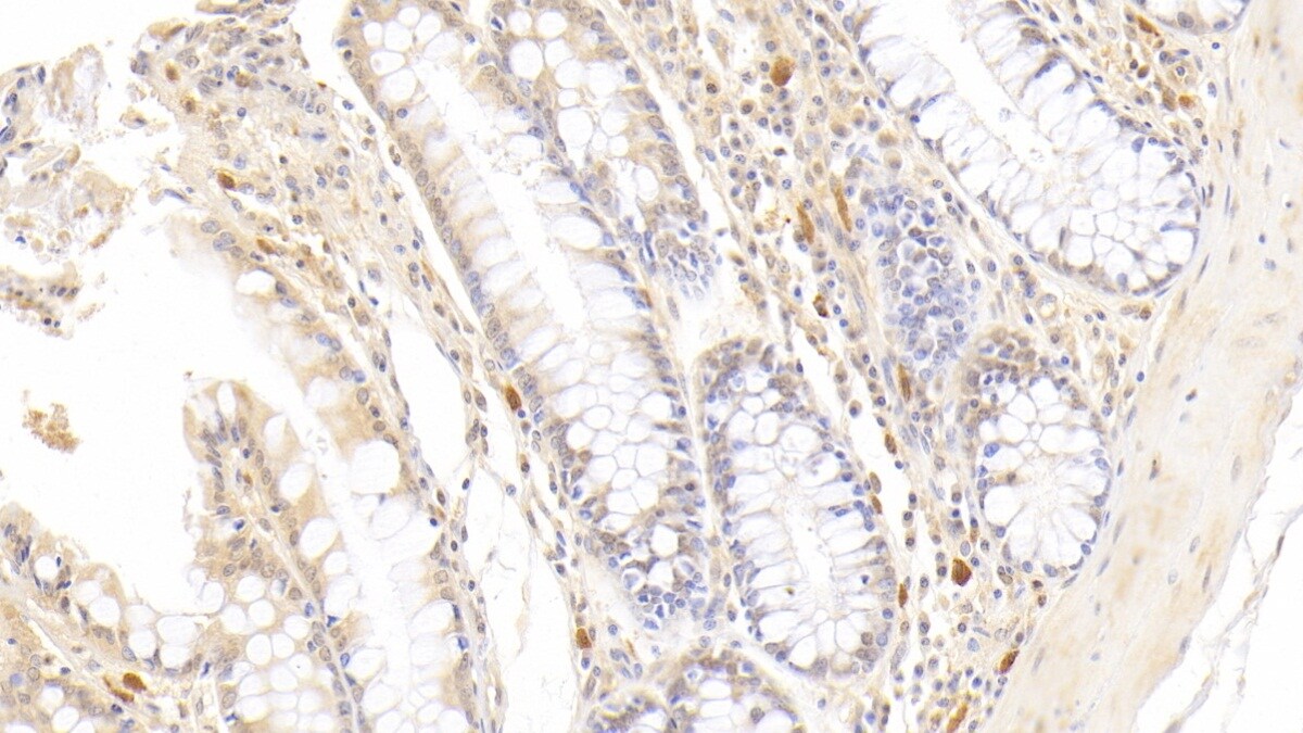 Eosinophil derived neurotoxin Antibody (C13)