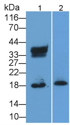 Eosinophil derived neurotoxin Antibody (C13)