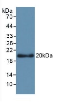 Apolipoprotein L2 Antibody (C1)