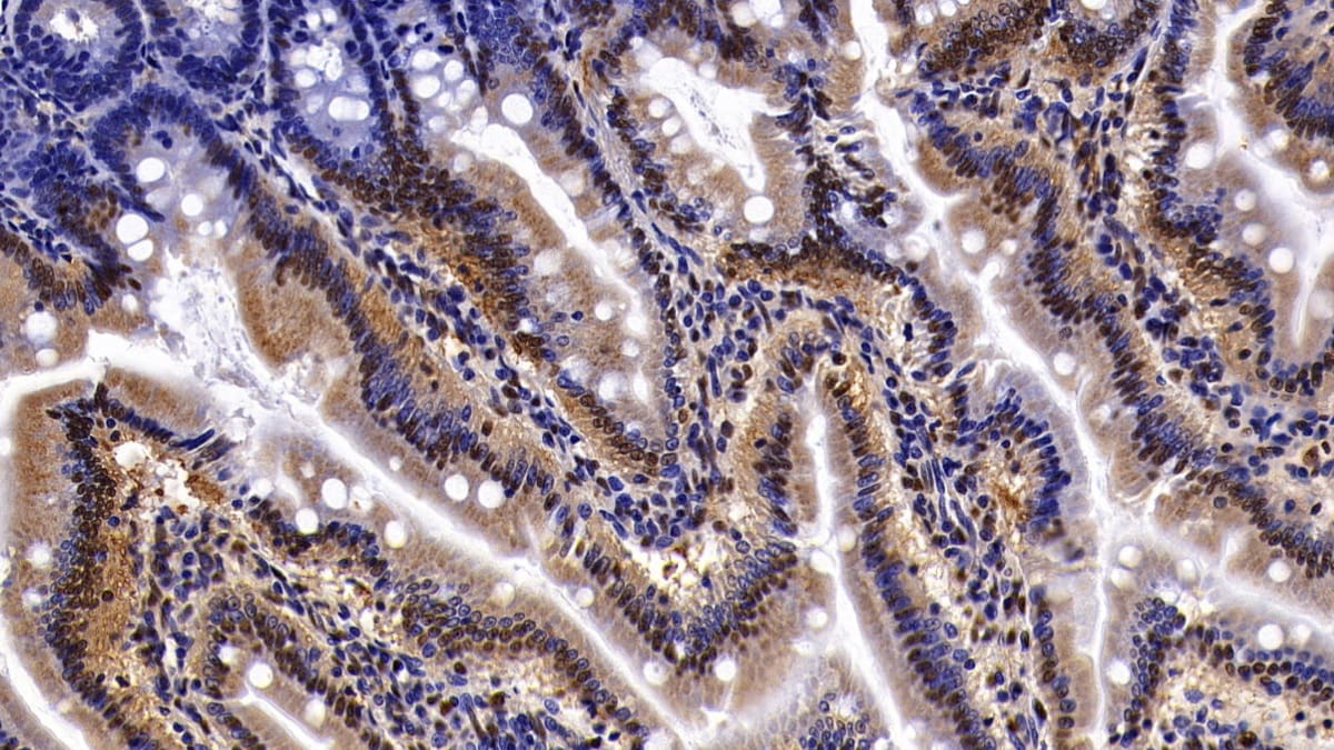 SAE2 Antibody