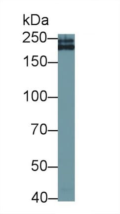 Collagen IV alpha3 Antibody (D2)