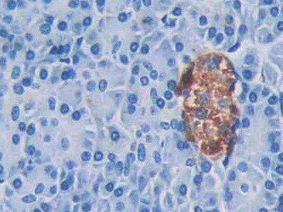 CAMP/Cathelicidin Antibody (C1)