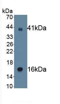 epithelial Sodium Channel gamma Antibody (C1)