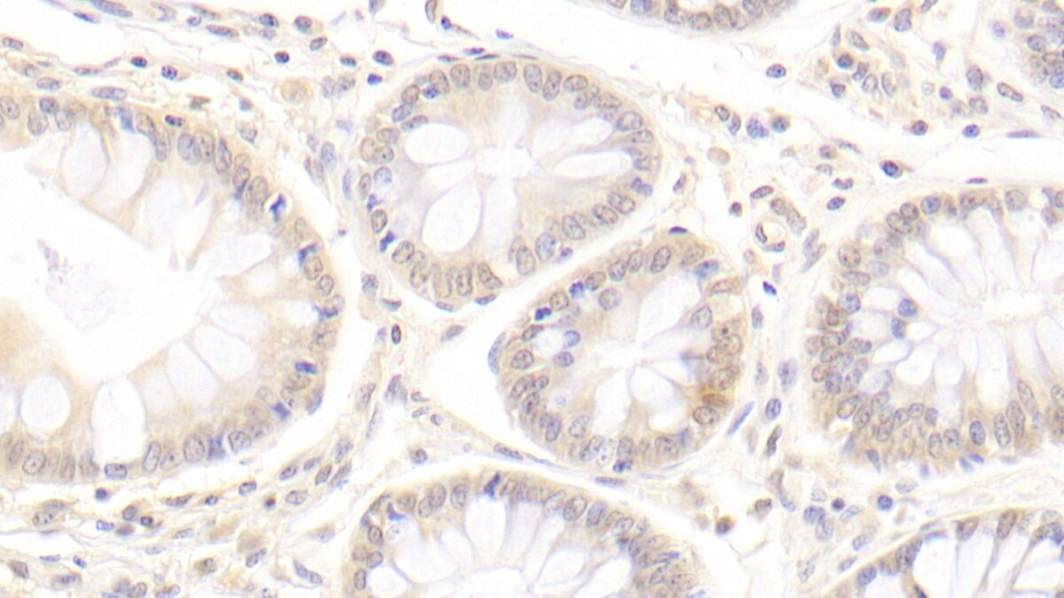 epithelial Sodium Channel gamma Antibody (C1)