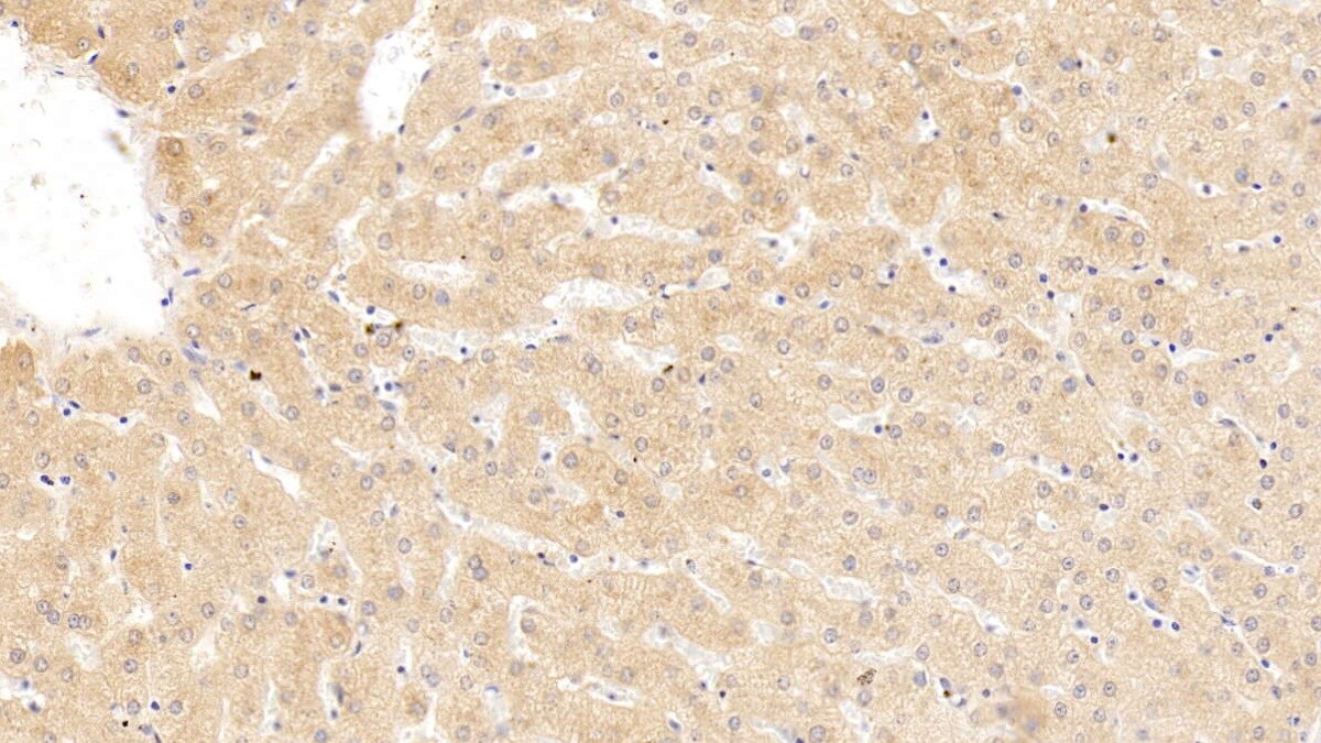 Serpin A10/ZPI Antibody (C4)