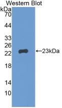 Gremlin 1 Antibody (C1)