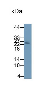 Noggin Antibody (A11)