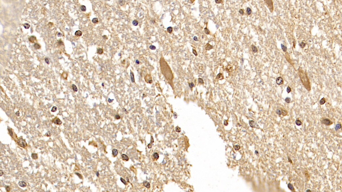 DCLK1 Antibody (C8)