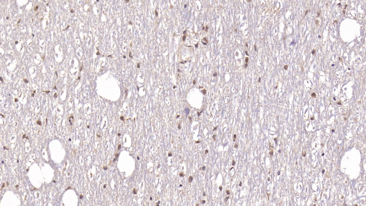 DCLK1 Antibody (C8)