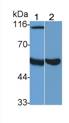 Heparanase/HPSE Antibody (C6)