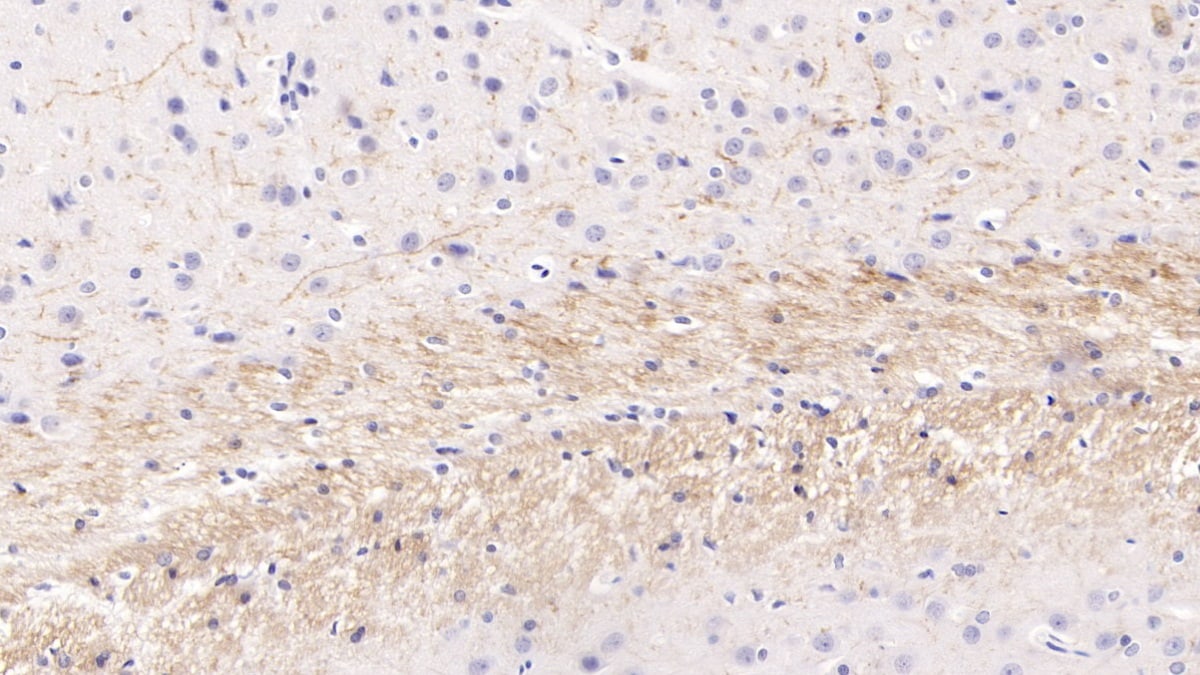 PTHLH/PTHrP Antibody (D4)