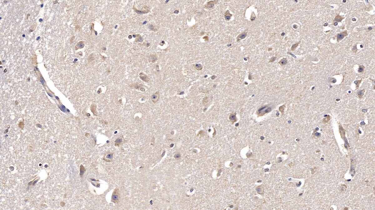 FGF-13 Antibody (C2)