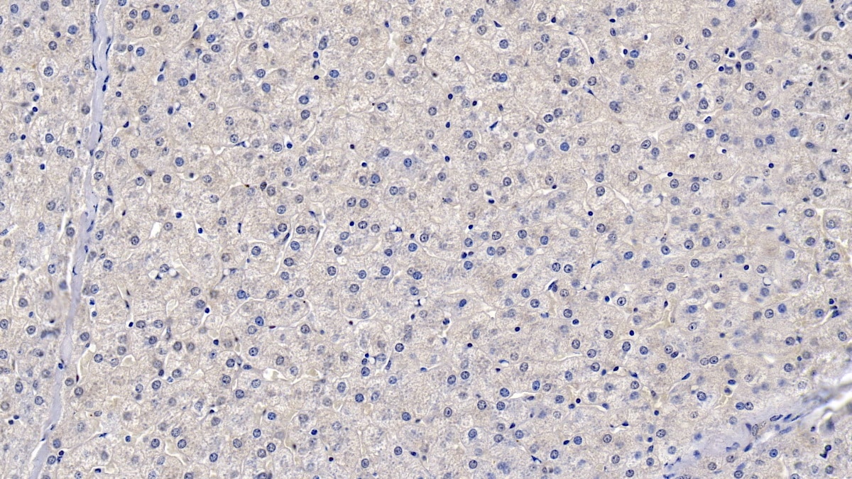 Apolipoprotein B100/ApoB100 Antibody (D10)