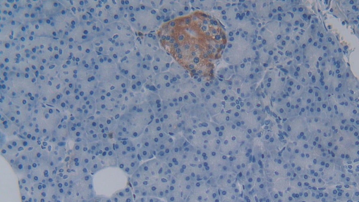 Lefty-1 Antibody (C8)