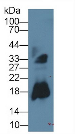 Eosinophil derived neurotoxin Antibody (C10)