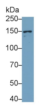 NMDAR2D Antibody (C6)