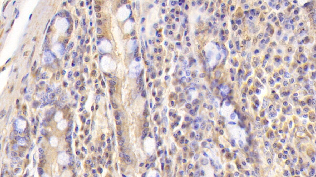 Apolipoprotein B100/ApoB100 Antibody (D8)