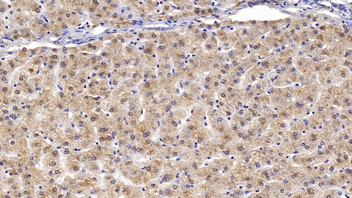 Apolipoprotein B100/ApoB100 Antibody (C2)
