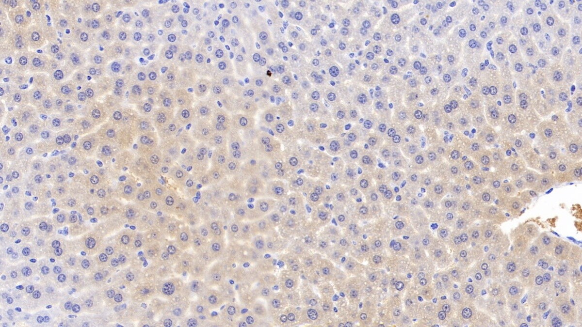 Apolipoprotein C1 Antibody (C6)