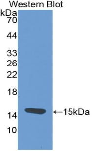 TSH beta Antibody (C2)