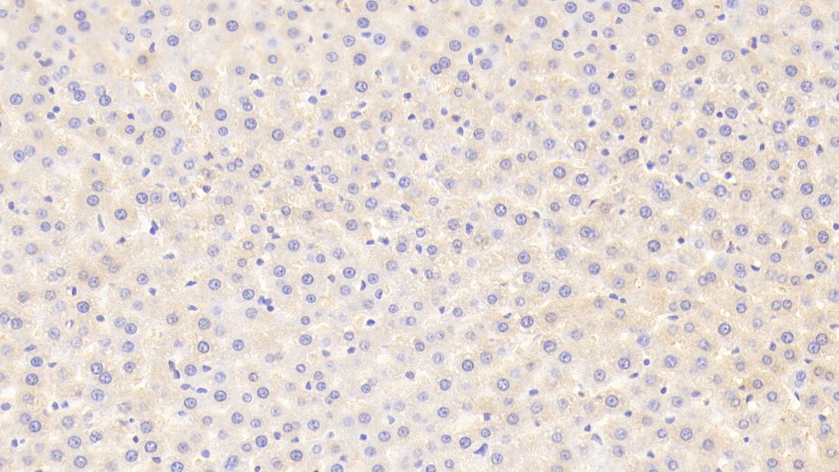 MAP3K6 Antibody