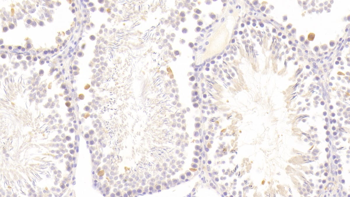 Glutathione Peroxidase 5 Antibody