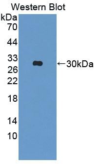 Triadin Antibody