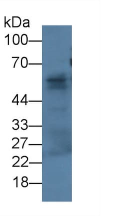 Fibulin-3/EFEMP1 Antibody (C1)