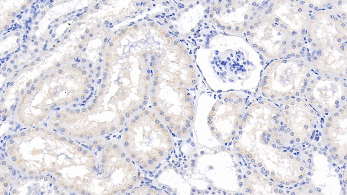 Eosinophil derived neurotoxin Antibody (C9)