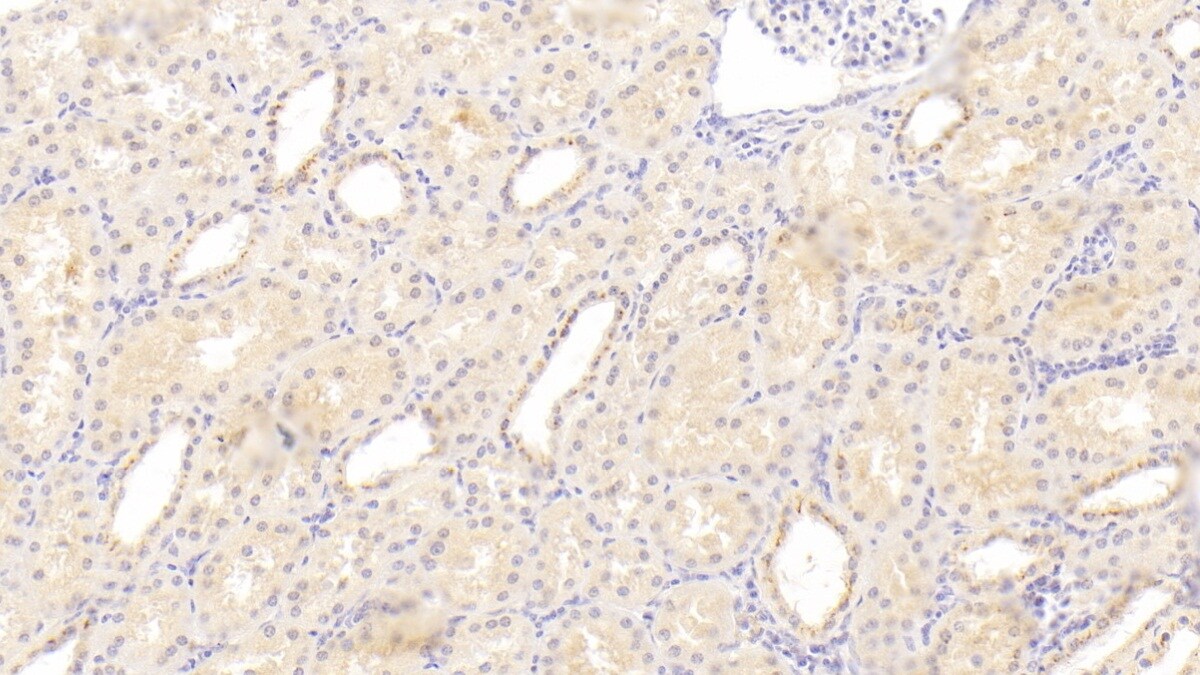 C1qTNF1/CTRP1 Antibody (C3)