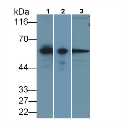 Calponin 2 Antibody (C6)