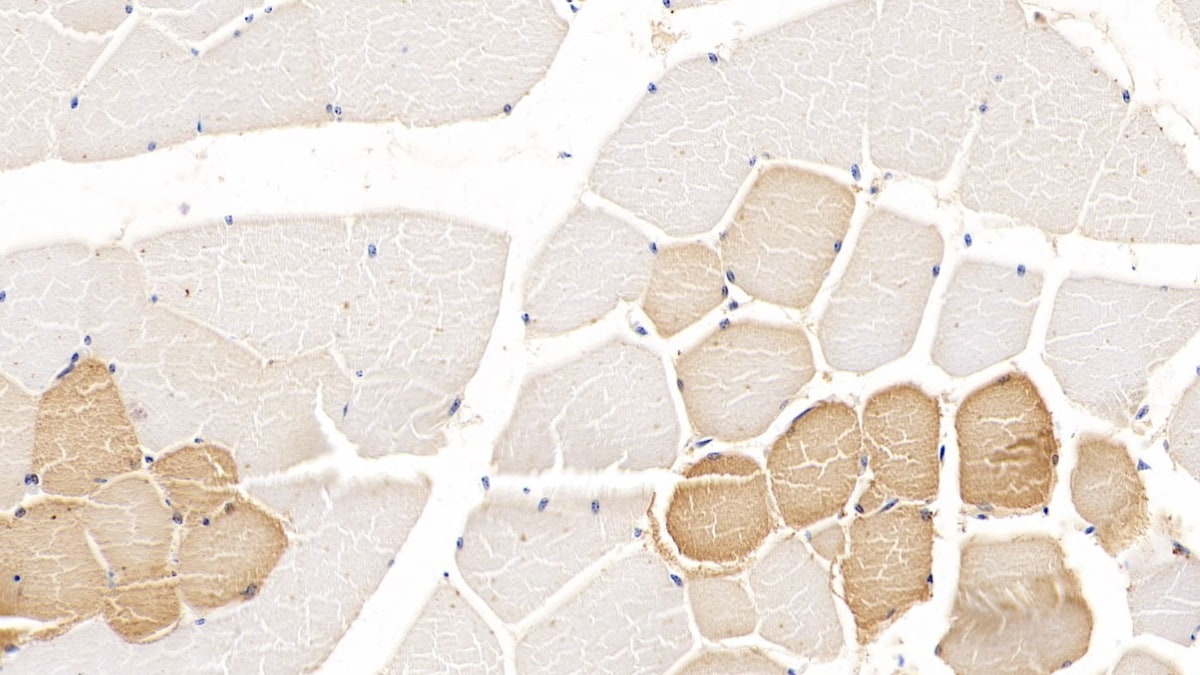 TDO2 Antibody (C2)